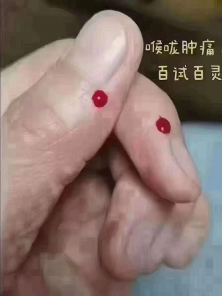 咽喉肿痛，这6个方法不用辩证